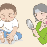 50代からは皮膚感染症に注意！「帯状疱疹」や「水虫」はうつる？家庭内で予防するポイントは【医師解説】