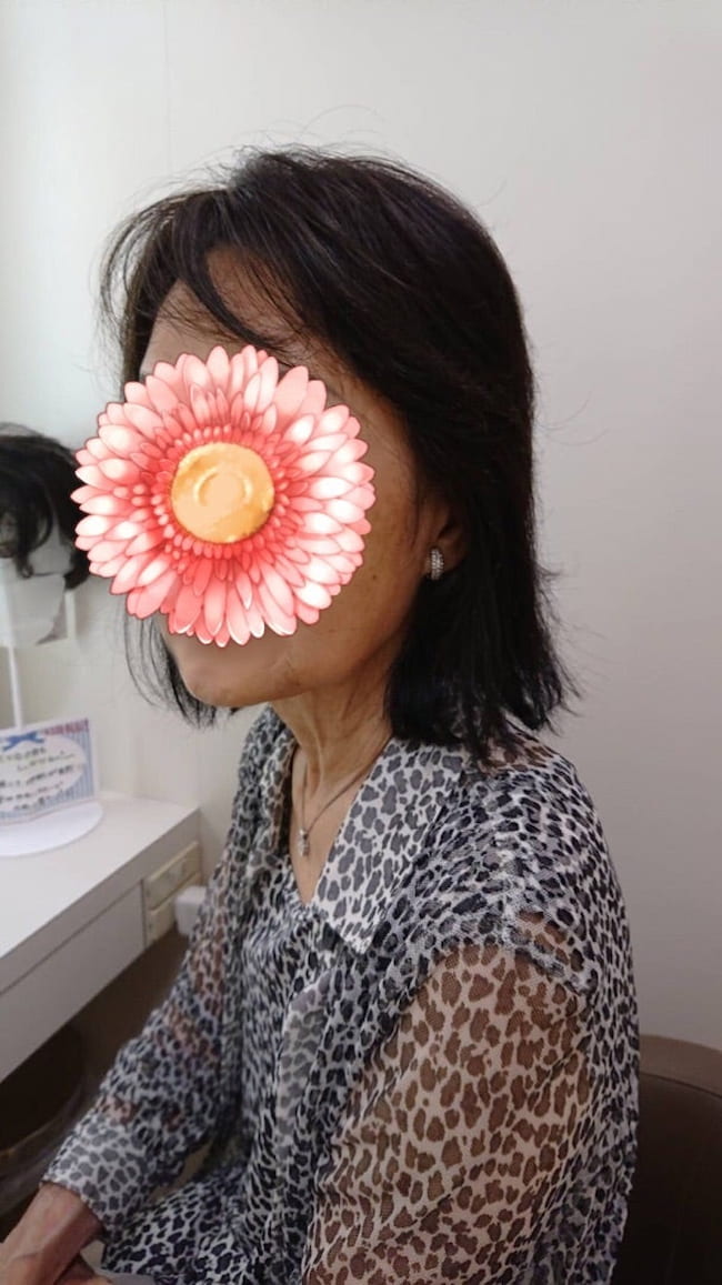 母の認知症介護日記/ワフウフ