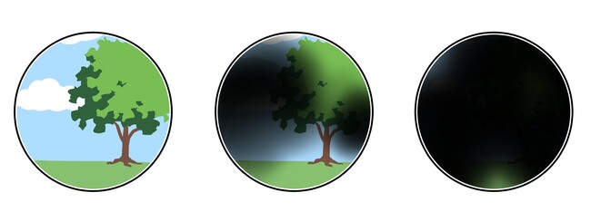 見え方の「欠け」は疲れ目じゃない!?緑内障のサインと予防法【医師解説】