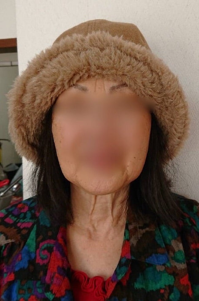 母の認知症介護日記/ワフウフ