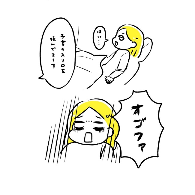 ミレーナ挿入レポ/ほけ
