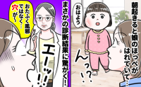 医師「ほっぺに穴が…」朝、右頬が大きく腫れていた娘→おたふく？虫歯？小児科での診断結果に後悔…実は