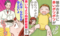 1歳前の娘の下半身に赤いポツポツ…医師「治すのに1カ月はかかると思って」えっ？おむつかぶれじゃないの！？