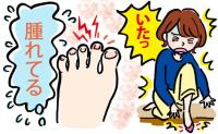 「深爪が原因で病気に！？」爪が肉に食い込んで腫れて、膿まで！診断された病名は【体験談】