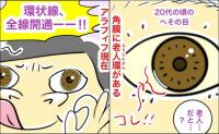 「黒目の縁が白く濁る？」高齢者に多い老人環とは一体 #緑内障ダイアリー 8