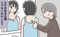 「吹き出物じゃないの？」できものに市販薬を塗るも悪化して膿が！切開することになった正体は