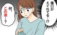 「傷口がえぐれてる」帝王切開の傷痕に謎の液。3回通院しても改善しない意外な原因【医師解説あり】