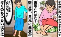 「虫刺され？」足の甲の赤いポチに塗り薬。数日後、足を引きずる痛みで受診した結果【医師解説あり】