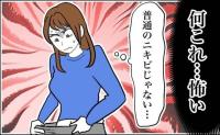 「ニキビが破裂した！？」足の付け根のできものをつかんだ直後、飛び出した小さな粒【医師解説あり】