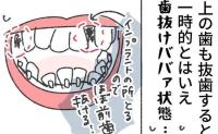 「マジあってよかった…！」歯列矯正中、歯抜け中年女のための神アイテム #くそ地味系40代独身女子 27