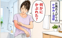 「何かにかぶれた？」長湯後のかゆみに加え、やがて湿疹も。40代が受診して言われたこと【医師監修】