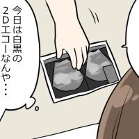妊婦健診で医師から渡された写真を見て困惑!どこの部分か全くわからず…