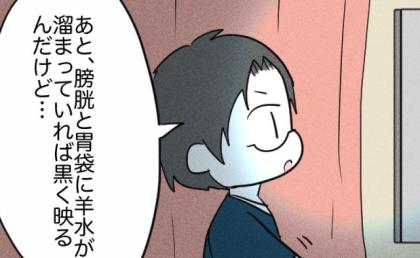 医師「異常は…」おなかの赤ちゃんを調べるために病院へ→検査方法を変えた結果、夫妻に衝撃が走り…！？ #不妊治療で妊娠した私の妊娠記録 3