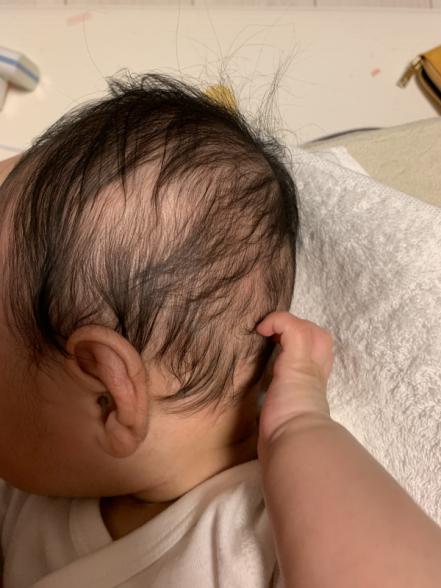 髪の毛をむしる【赤ちゃんの生活】|ベビーカレンダー専門家相談