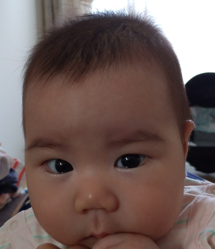 斜視でしょうか 医療専門家が個別回答 妊娠 出産 子育ての悩みを解決するオンライン相談 ベビーカレンダー