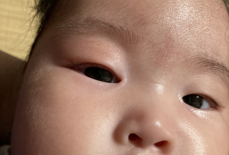 アレルギー反応でしょうか 医療専門家が個別回答 妊娠 出産 子育ての悩みを解決するオンライン相談 ベビーカレンダー