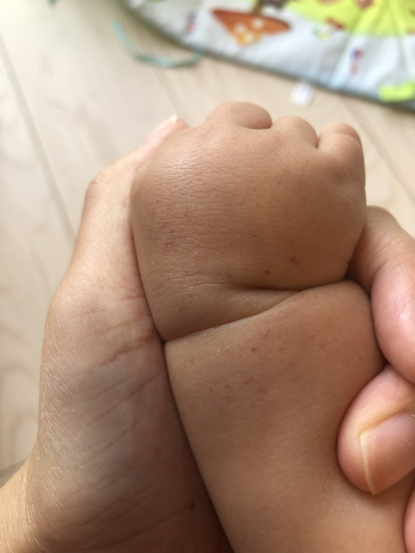 これ病気でしょうか 医療専門家が個別回答 妊娠 出産 子育ての悩みを解決するオンライン相談 ベビーカレンダー