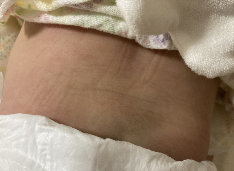 至急お願いします 医療専門家が個別回答 妊娠 出産 子育ての悩みを解決するオンライン相談 ベビーカレンダー