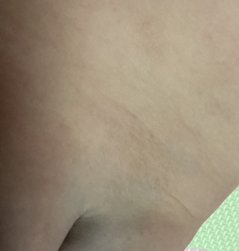 至急お願いします 医療専門家が個別回答 妊娠 出産 子育ての悩みを解決するオンライン相談 ベビーカレンダー