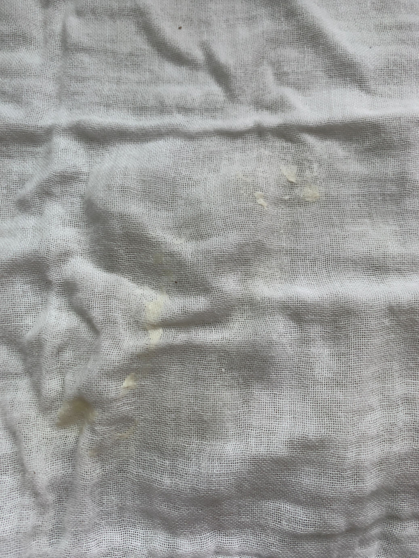 毎日の吐き戻し 医療専門家が個別回答 妊娠 出産 子育ての悩みを解決するオンライン相談 ベビーカレンダー