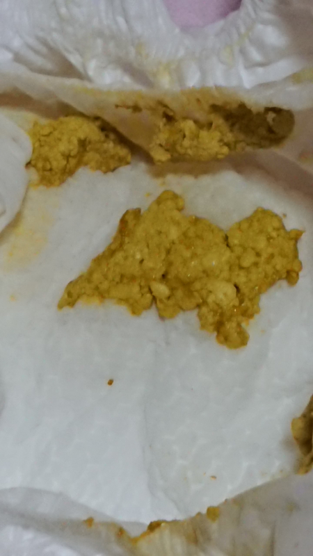 生後2週間の赤ちゃんの便について 医療専門家が個別回答 妊娠 出産 子育ての悩みを解決するオンライン相談 ベビーカレンダー