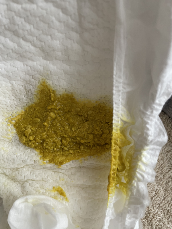 うんちの色について 医療専門家が個別回答 妊娠 出産 子育ての悩みを解決するオンライン相談 ベビーカレンダー