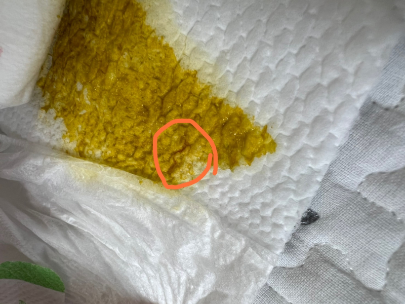 うんちに少し血が混じることについて 医療専門家が個別回答 妊娠 出産 子育ての悩みを解決するオンライン相談 ベビーカレンダー