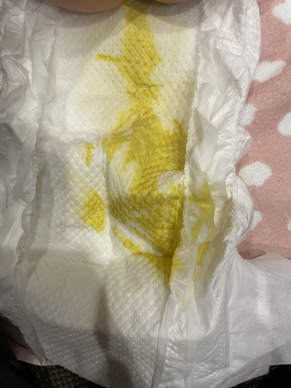 下痢について 医療専門家が個別回答 妊娠 出産 子育ての悩みを解決するオンライン相談 ベビーカレンダー