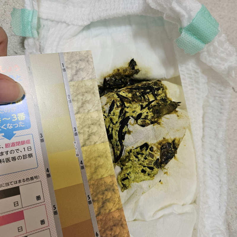 便の匂いがいつもと違う【赤ちゃんの病気・ケガ】|ベビーカレンダー専門家相談