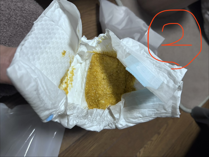 便の色について【赤ちゃんの病気・ケガ】|ベビーカレンダー専門家相談