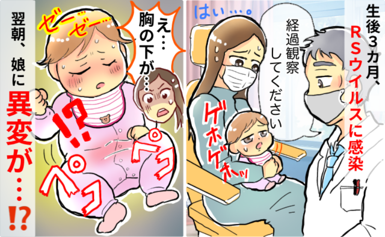 胸の下がペコペコしてる！？「やばいかも…」RSウイルスに感染した娘→病院を受診するとまさかの事態に！