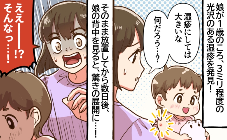 「ただの湿疹じゃない…光ってる！？」娘の腕に不思議な湿疹を発見！→数日後、背中を見るとゾッとする事態に！？