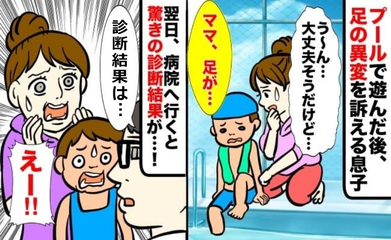 プールで楽しく遊んだだけなのに？息子の足に異変…病院を受診すると思いもよらない診断結果が！