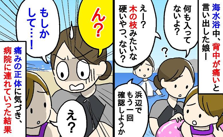「痛い！」海水浴中、水着の中に木の枝が入ったと訴える娘→海から上がって確認した結果、娘を襲ったものの正体は…