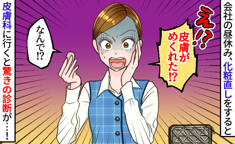 メイク直し中、皮膚が“ペラッ”とむけて…慌てて皮膚科を受診。乾燥ではない診断結果に驚き！原因は？