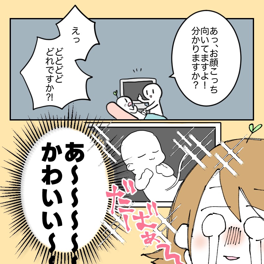 不妊治療で妊娠した私の妊娠記録/kiki