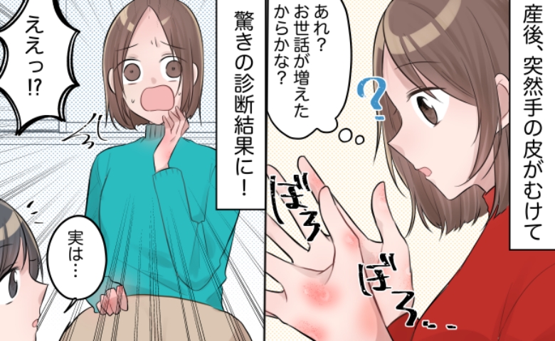 「手のひら全体の皮がむけて痛い…！」出産1カ月後に異変！？医師に告げられた思いもよらない病名とは