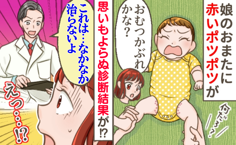 1歳前の娘の下半身に赤いポツポツ…医師「治すのに1カ月はかかると思って」えっ？おむつかぶれじゃないの！？