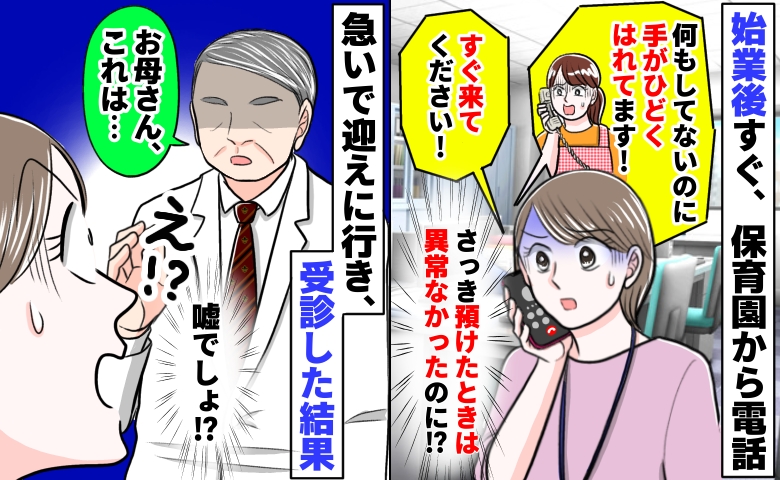 保育園へ預けてすぐ呼び出し「手がパンパンに腫れてます！すぐ来て！」異常なかったのに！？受診の結果