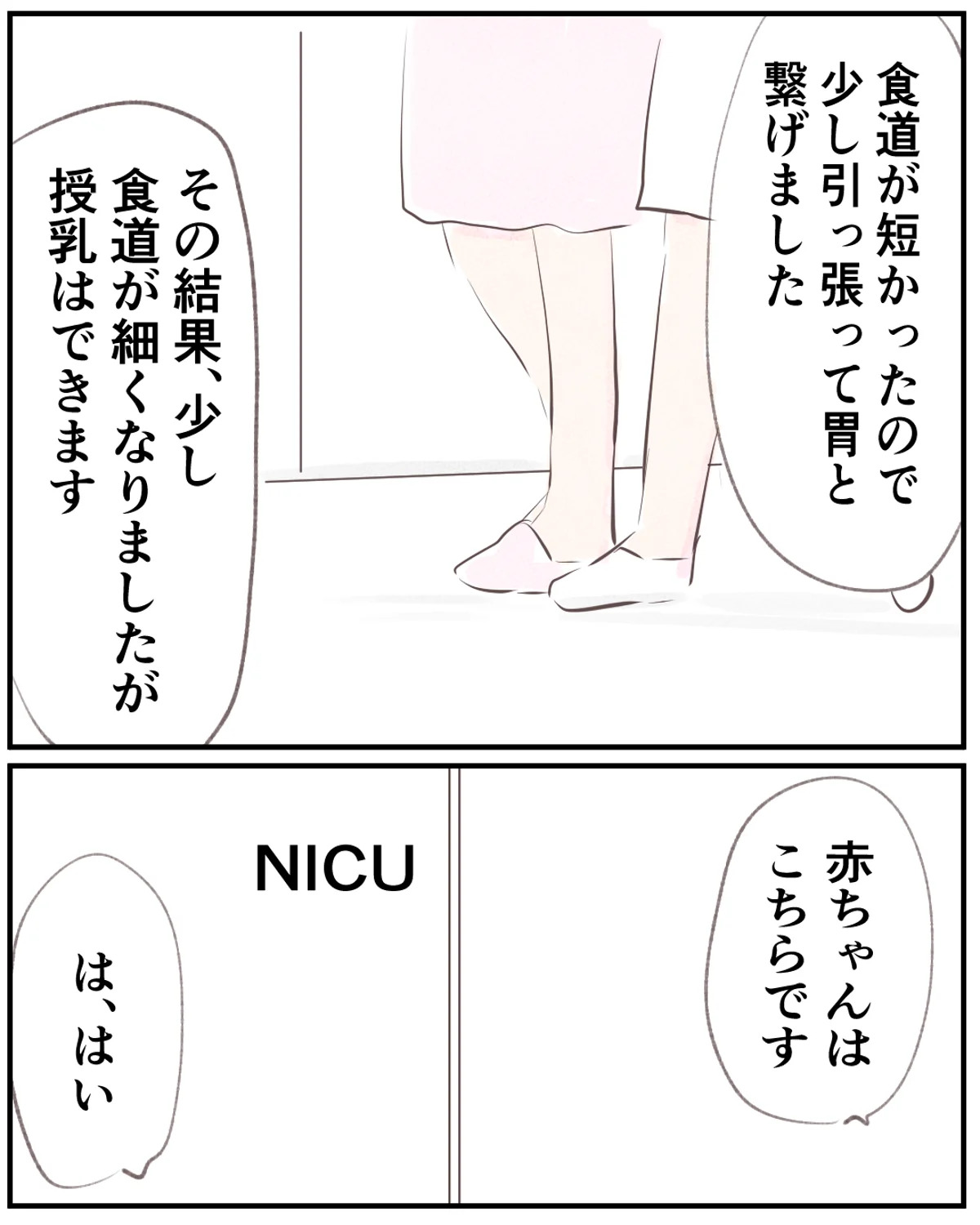 先天性食道閉鎖症／ようみん
