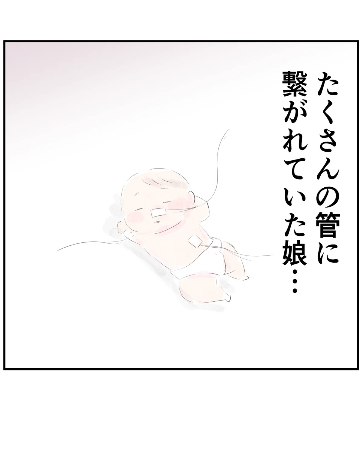 先天性食道閉鎖症／ようみん