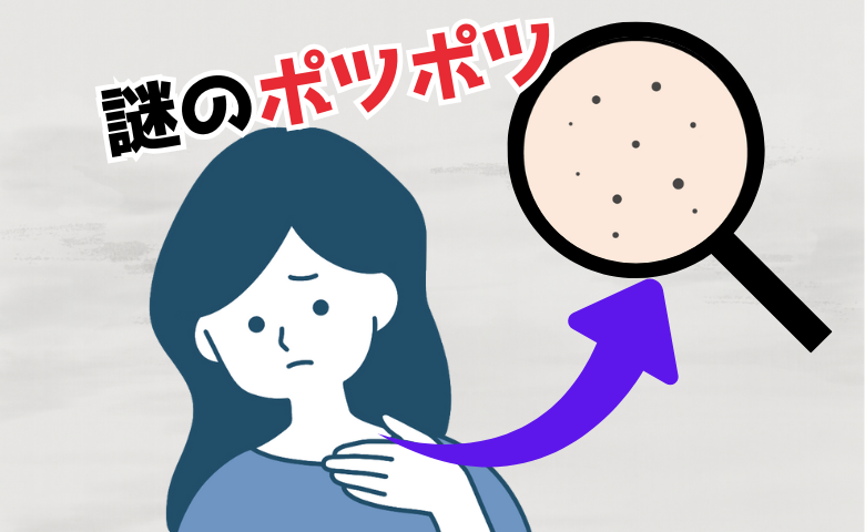 「首周りに謎のポツポツが…」もしかしてイボ？年齢のせい？私が試したことは【体験談】