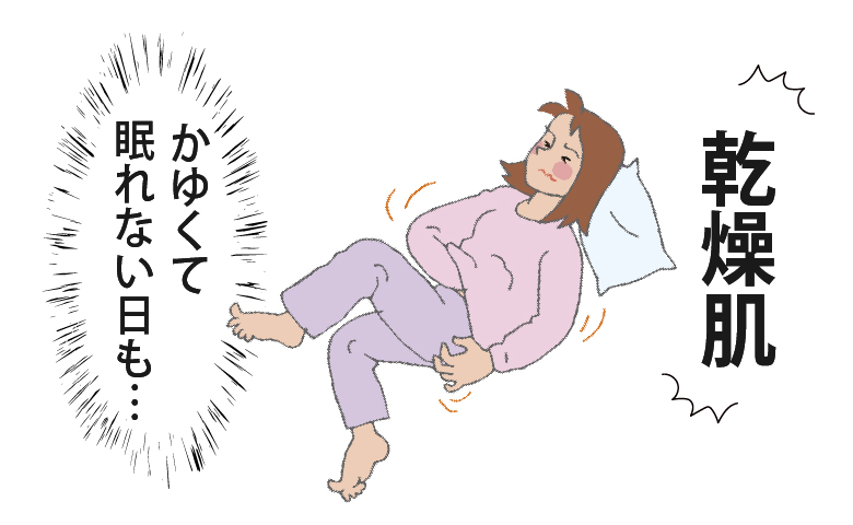 下着のゴムでかゆみが悪化！乾燥肌の40代が肌に触れる下着の素材を見直してみた結果は