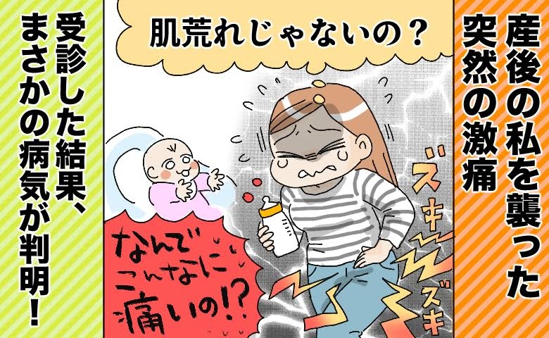 産後の私を襲った突然の激痛「肌荒れだと思っていたら…」受診した結果、まさかの病気が判明