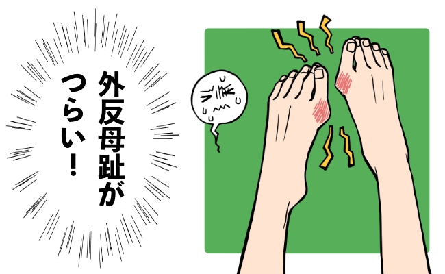 「外反母趾がつらい…」靴底職人に見てもらったらまさかの変化が！