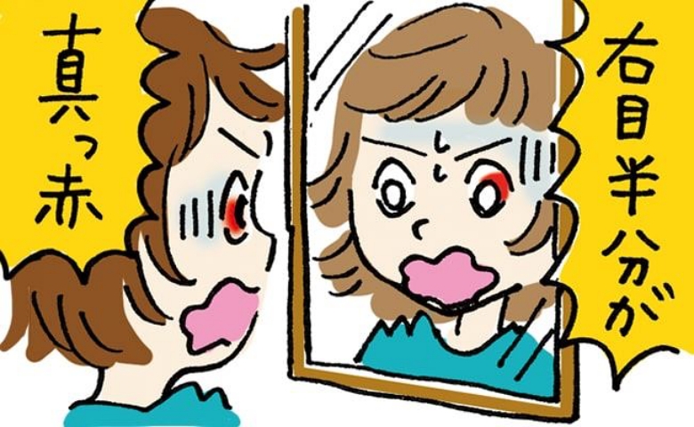 「ドキッ」突然、白目が真っ赤に！どんどん範囲が広がり眼科を受診した結果、判明した病名は