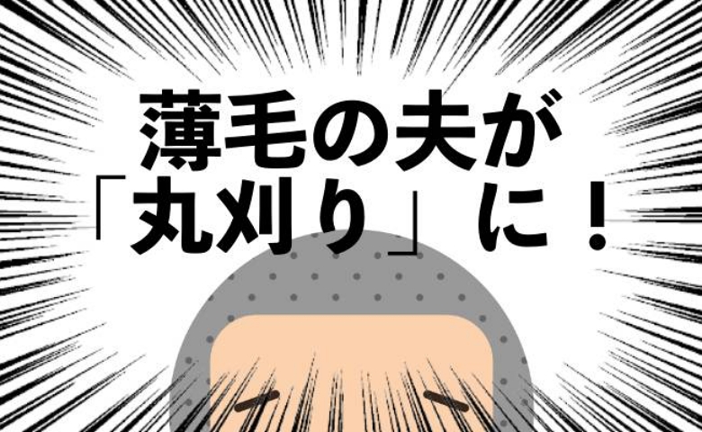 薄毛だった友人の髪が増えていた!夫もマネして治療を始めた結果、3カ月後に見えた変化とは