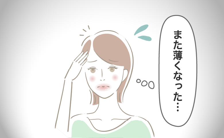 「今のままではマズイ！」どんどん薄毛になった40代。悩んだ私が選んだ3つの抜け毛対策とは