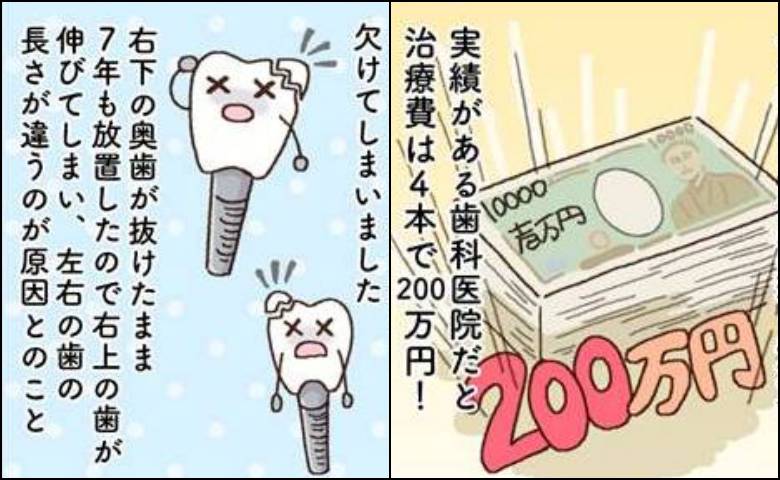 「なぜ欠けたの！？」200万円かけたインプラントが破損。歯科医から告げられた予想外の原因
