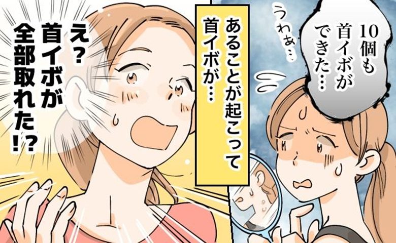 「あれ？首イボが取れた！？」10個もできていたイボがシートベルトに直撃した結果、予想外の展開に